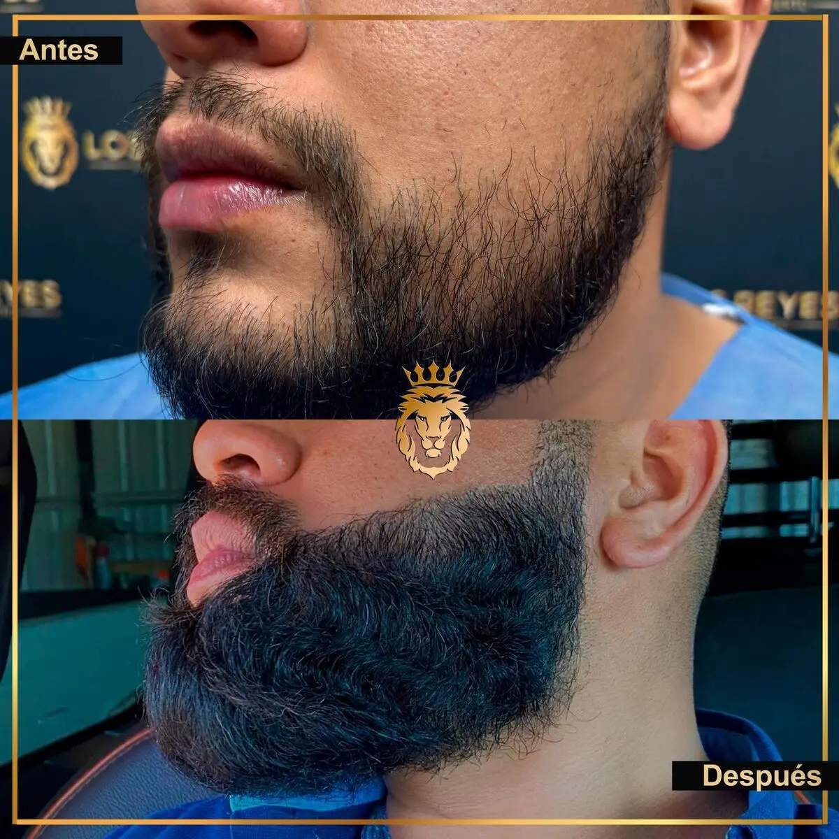 caso_barba_35